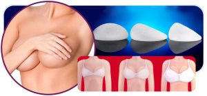 Prótese de Silicone: como escolher o melhor formato e volume para cada paciente